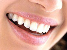 Os seus dentes estão todos na boca?