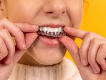 dentes
